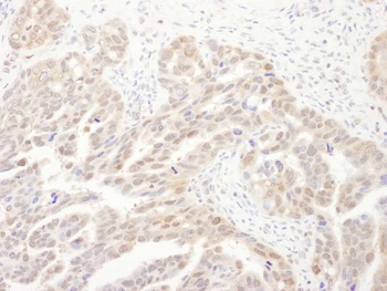 Rabbit anti-PSMA6 Antibody, Affinity Purified