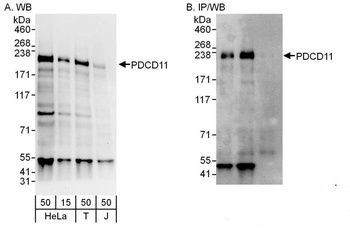Rabbit anti-PDCD11 Antibody, Affinity Purified