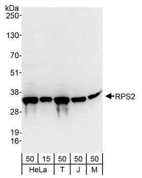 Rabbit anti-RPS2 Antibody, Affinity Purified