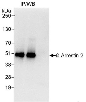 Rabbit anti-Beta-Arrestin 2 Antibody, Affinity Purified
