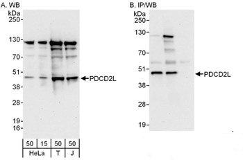 Rabbit anti-PDCD2L Antibody, Affinity Purified