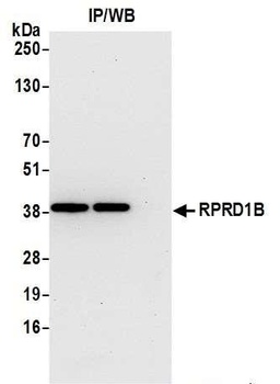 Rabbit anti-RPRD1B Antibody, Affinity Purified