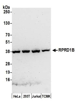 Rabbit anti-RPRD1B Antibody, Affinity Purified