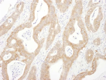 Rabbit anti-Beta-Arrestin 1 Antibody, Affinity Purified
