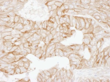 Rabbit anti-Alpha-Adducin Antibody, Affinity Purified
