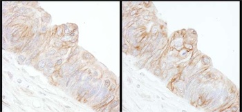 Rabbit anti-Alpha-Adducin Antibody, Affinity Purified
