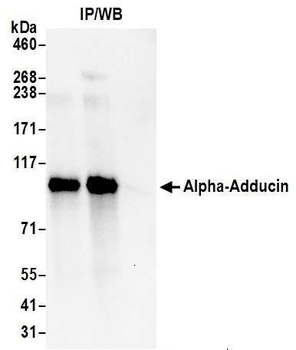 Rabbit anti-Alpha-Adducin Antibody, Affinity Purified
