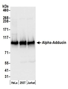 Rabbit anti-Alpha-Adducin Antibody, Affinity Purified