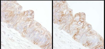 Rabbit anti-Alpha-Adducin Antibody, Affinity Purified
