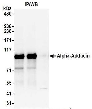 Rabbit anti-Alpha-Adducin Antibody, Affinity Purified