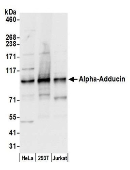 Rabbit anti-Alpha-Adducin Antibody, Affinity Purified