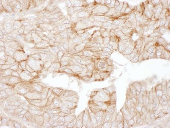 Rabbit anti-Alpha-Adducin Antibody, Affinity Purified