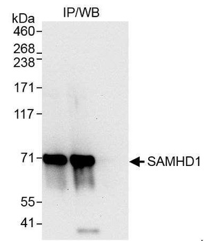 Rabbit anti-SAMHD1 Antibody, Affinity Purified