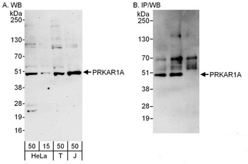 Rabbit anti-PRKAR1A Antibody, Affinity Purified