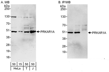 Rabbit anti-PRKAR1A Antibody, Affinity Purified