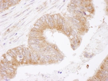 Rabbit anti-Bcl-2 Antibody, Affinity Purified