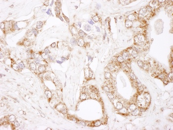 Rabbit anti-Bcl-2 Antibody, Affinity Purified