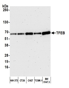 Rabbit anti-TFEB Antibody, Affinity Purified