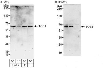 Rabbit anti-TOE1 Antibody, Affinity Purified