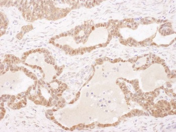 Rabbit anti-GSTP1 Antibody, Affinity Purified