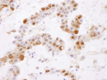 Rabbit anti-GSTP1 Antibody, Affinity Purified