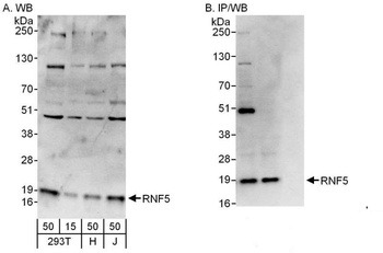 Rabbit anti-RNF5 Antibody, Affinity Purified