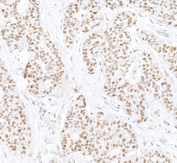 Rabbit anti-PARN Antibody, Affinity Purified