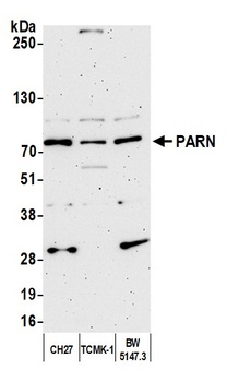 Rabbit anti-PARN Antibody, Affinity Purified
