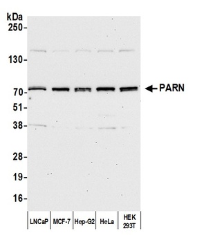 Rabbit anti-PARN Antibody, Affinity Purified