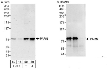 Rabbit anti-PARN Antibody, Affinity Purified