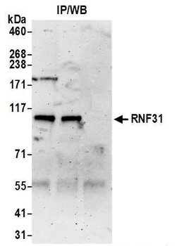 Rabbit anti-RNF31 Antibody, Affinity Purified