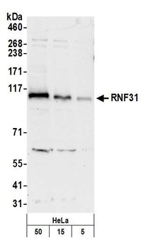 Rabbit anti-RNF31 Antibody, Affinity Purified