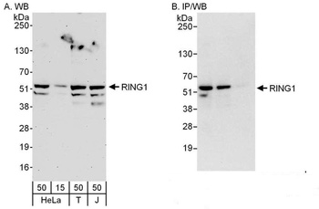 Rabbit anti-RING1 Antibody, Affinity Purified