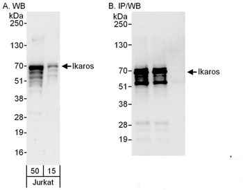 Rabbit anti-Ikaros Antibody, Affinity Purified