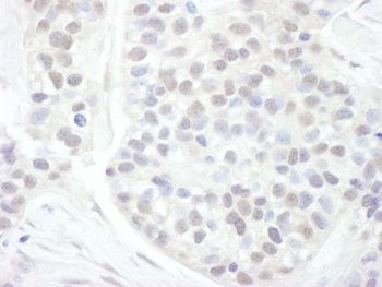 Rabbit anti-Cyclin T1 Antibody, Affinity Purified