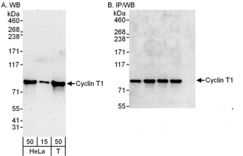 Rabbit anti-Cyclin T1 Antibody, Affinity Purified