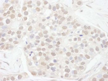 Rabbit anti-Cyclin T1 Antibody, Affinity Purified