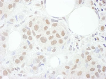 Rabbit anti-Cyclin T1 Antibody, Affinity Purified