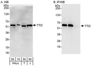Rabbit anti-TTI2 Antibody, Affinity Purified