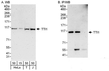 Rabbit anti-TTI1 Antibody, Affinity Purified
