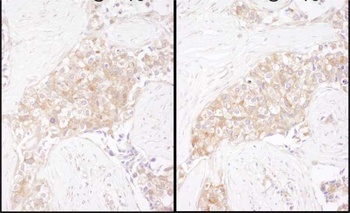 Rabbit anti-TCP1 Antibody, Affinity Purified