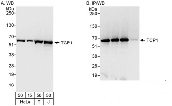 Rabbit anti-TCP1 Antibody, Affinity Purified