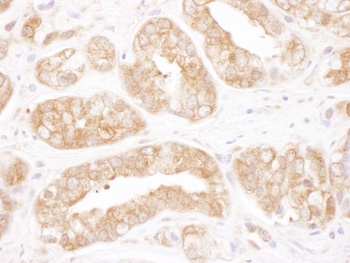 Rabbit anti-TCP1 Antibody, Affinity Purified