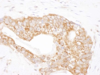 Rabbit anti-TCP1 Antibody, Affinity Purified