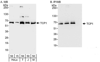 Rabbit anti-TCP1 Antibody, Affinity Purified