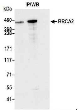 Rabbit anti-BRCA2 Antibody, Affinity Purified