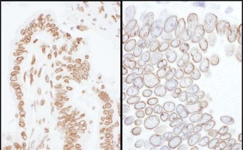 Rabbit anti-Lamin-A/C Antibody, Affinity Purified
