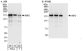 Rabbit anti-INF2 Antibody, Affinity Purified