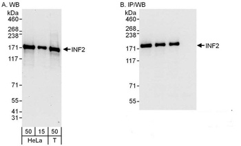 Rabbit anti-INF2 Antibody, Affinity Purified