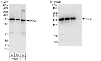 Rabbit anti-INF2 Antibody, Affinity Purified